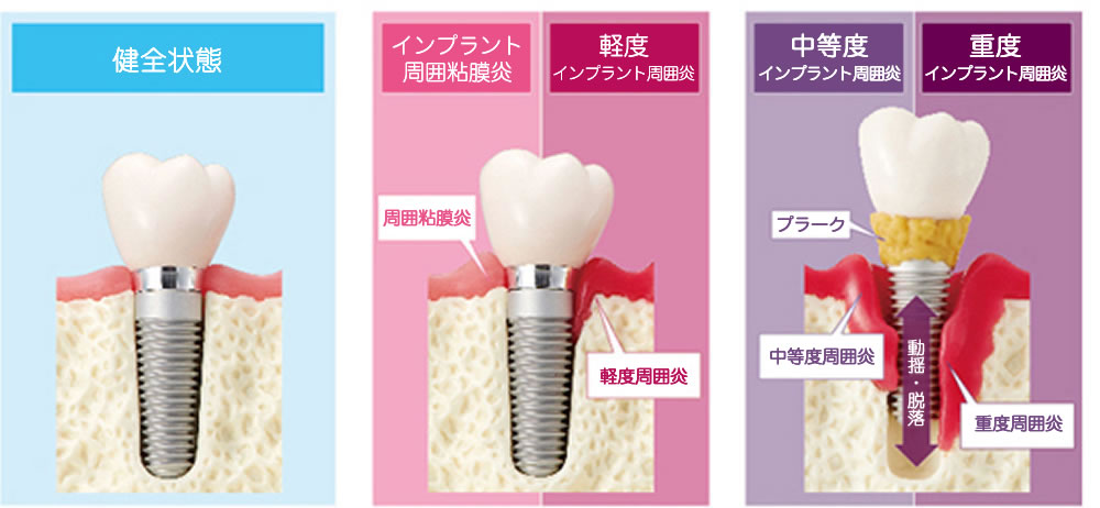 ご提案とカウンセリング