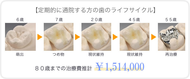 予防に取り組んでいる人と痛い時にだけ治療する人の治療費の比較