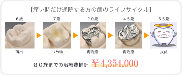 予防に取り組んでいる人と痛い時にだけ治療する人の治療費の比較