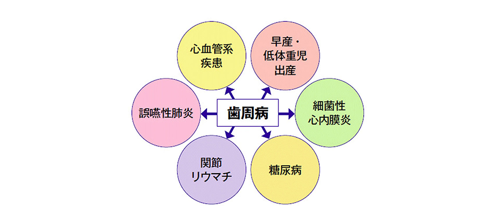 歯周病は様々な全身疾患とも深く関係しています